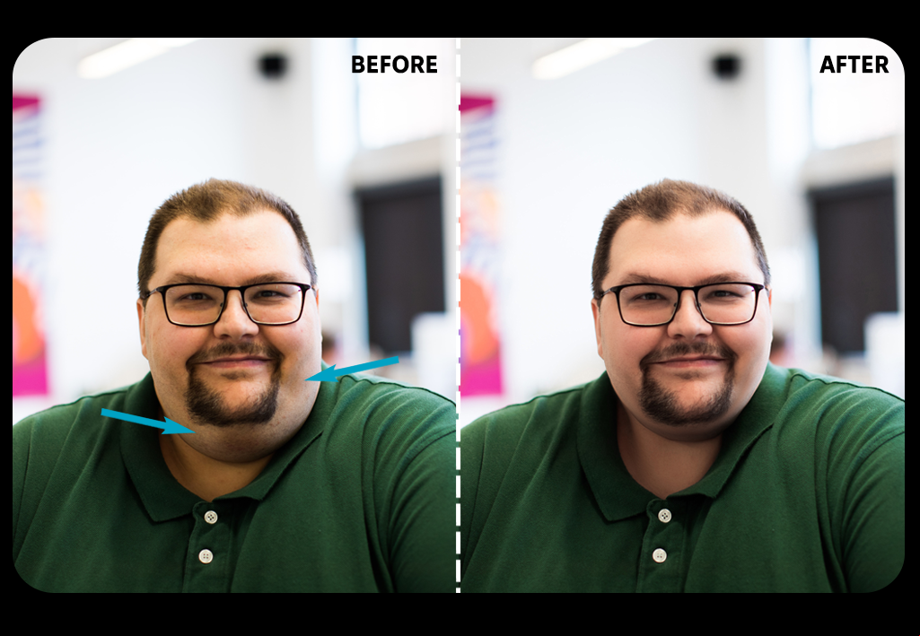 app to get rid of double chin