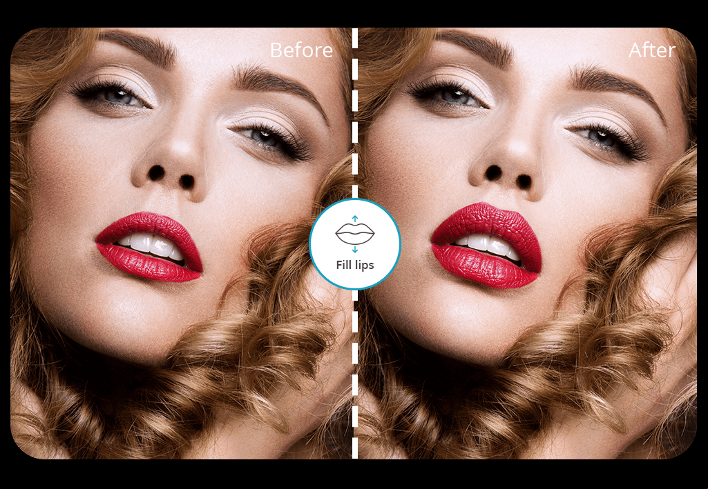 lip filler filter cover