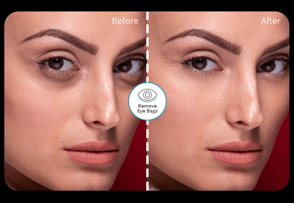 app to remove eye bags cover